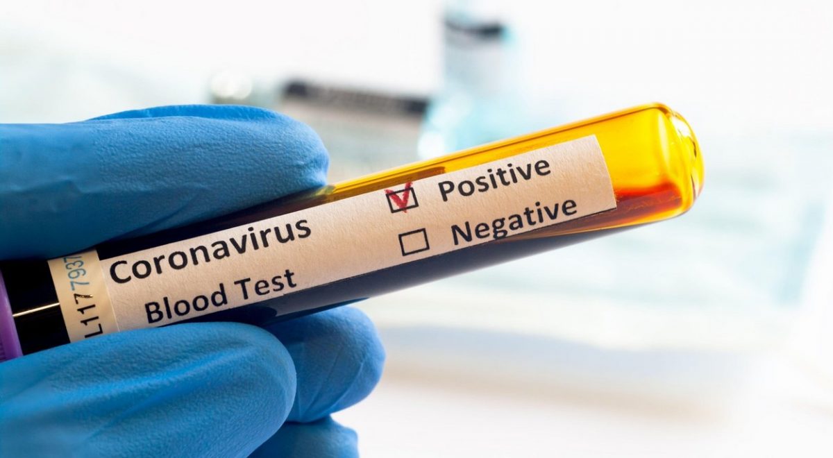koronavirus umrljivost v sloveniji