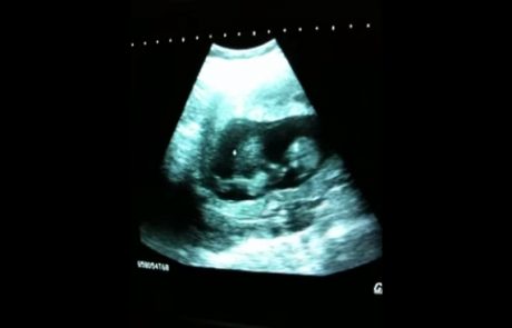 To je najbolj simpatičen posnetek ultrazvoka vseh časov