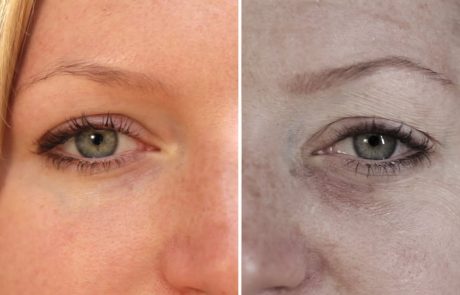 Poglejte, kako se spremeni videz obraza, če ne spimo dovolj (Video)