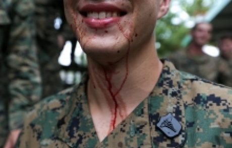FOTO: Krvava vojaška vaja