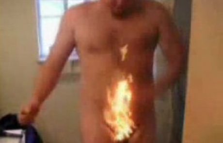 VIDEO: Po nesreči si je zažgal penis!
