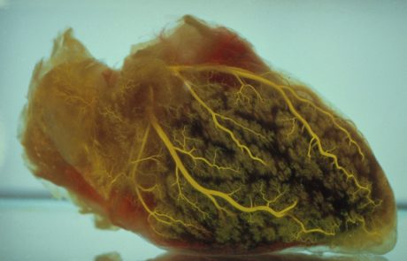Velik preboj na področju medicine: Izraelski znanstveniki natisnili 3D srce iz človeškega tkiva