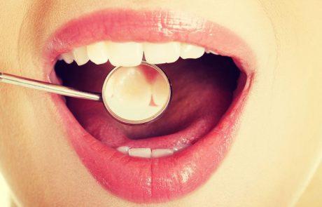 7 resnic, ki jih zobozdravnik odkrije, ko pogleda v vaša usta