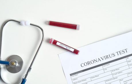 Pozor, ne nasedajte nepreverjenim testom za dokazovanje okužb z novim koronavirusom