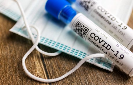 V nedeljo potrdili 229 okužb z novim koronavirusom
