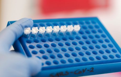 Včeraj s PCR testi potrdili 4469 okužb z novim koronavirusom
